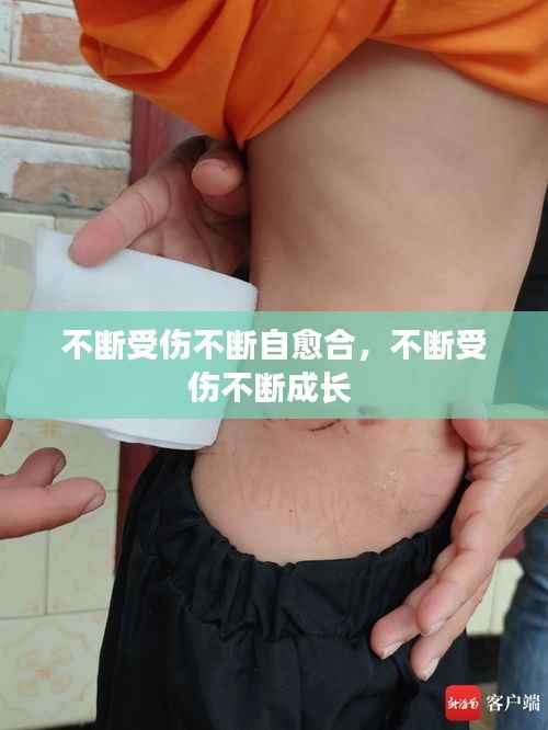 不断受伤不断自愈合,不断受伤不断成长